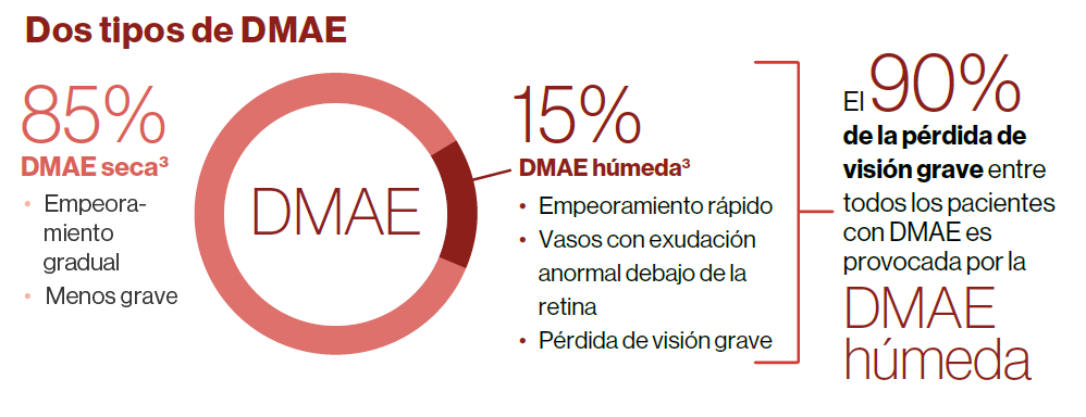 Infografía que representa los dos tipos de DMAE y su afectación en la población. La DMAE seca afecta al 85% y la húmeda al 15%. Remarca que el 90% de la pérdida de visión grave viene provocada por los casos de DMAE húmeda.